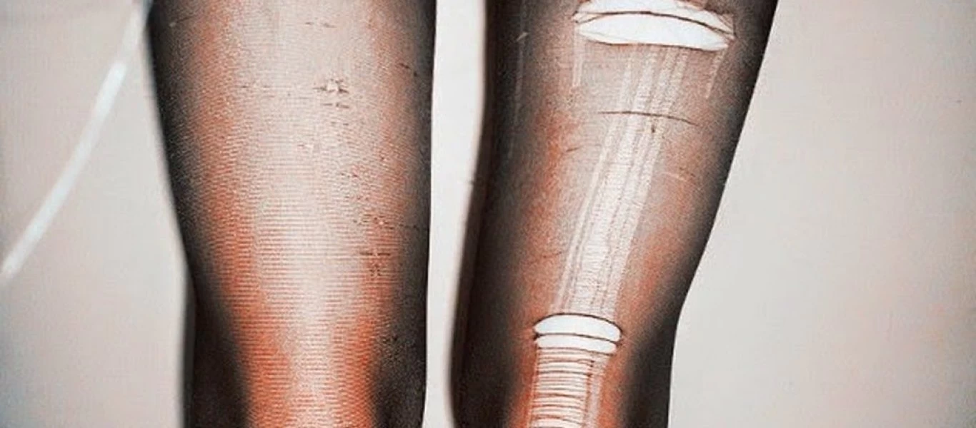 Που θα σας φανεί χρήσιμο το σκισμένο καλσόν